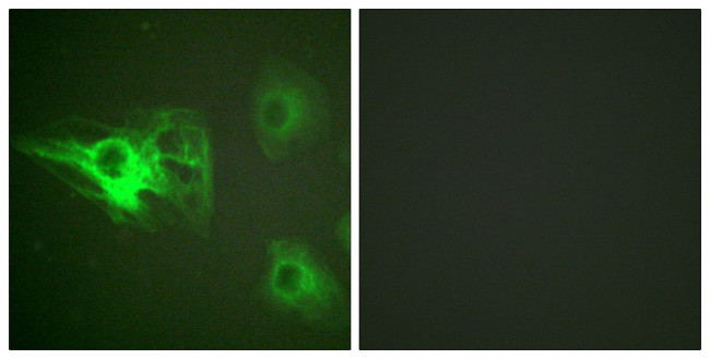 Phospho-Cytokeratin 8 (Ser432) Antibody in Immunocytochemistry (ICC/IF)