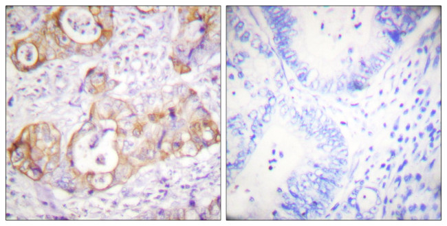 Phospho-Cytokeratin 8 (Ser432) Antibody in Immunohistochemistry (Paraffin) (IHC (P))