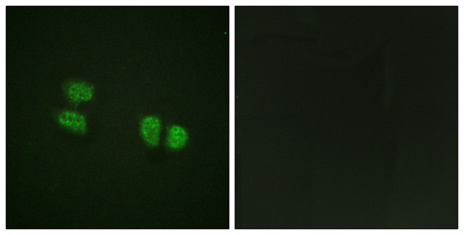 Phospho-DDX5 (Tyr593) Antibody in Immunocytochemistry (ICC/IF)