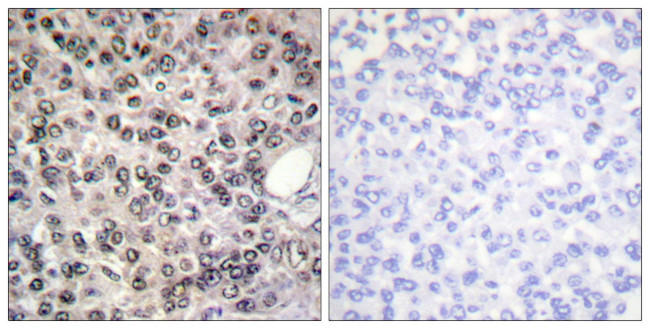 Phospho-DDX5 (Tyr593) Antibody in Immunohistochemistry (Paraffin) (IHC (P))