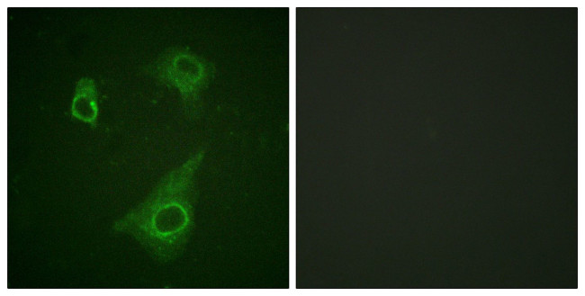 Phospho-EpoR (Tyr368) Antibody in Immunocytochemistry (ICC/IF)