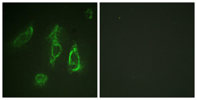 EpoR Antibody in Immunocytochemistry (ICC/IF)