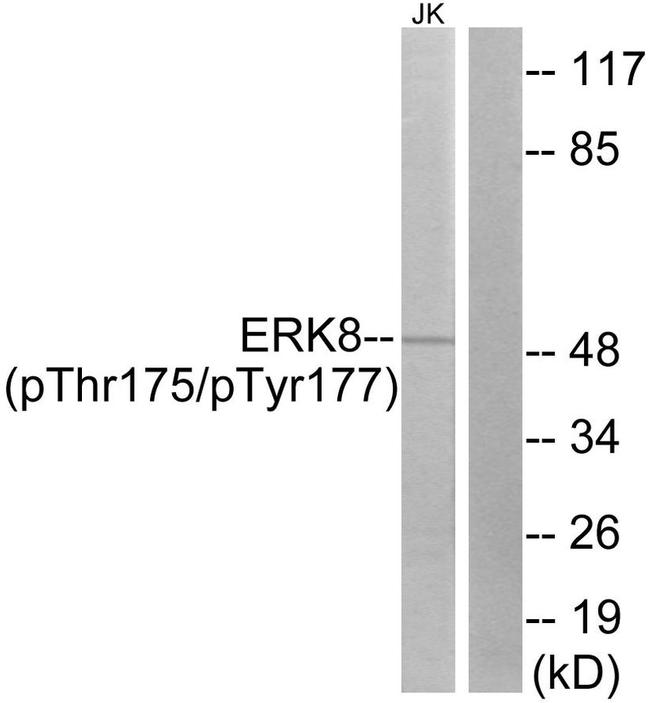 Phospho-MAPK15 (Thr175, Tyr177) Antibody in Western Blot (WB)