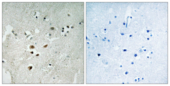 Phospho-ELK3 (Ser357) Antibody in Immunohistochemistry (Paraffin) (IHC (P))