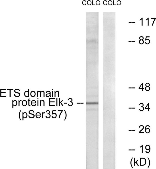 Phospho-ELK3 (Ser357) Antibody in Western Blot (WB)