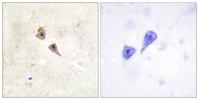 Phospho-IFNAR1 (Tyr466) Antibody in Immunohistochemistry (Paraffin) (IHC (P))