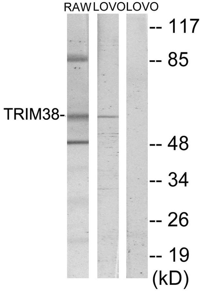 TRIM38 Antibody in Western Blot (WB)