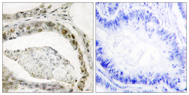 Phospho-SMAD3 (Ser208) Antibody in Immunohistochemistry (Paraffin) (IHC (P))