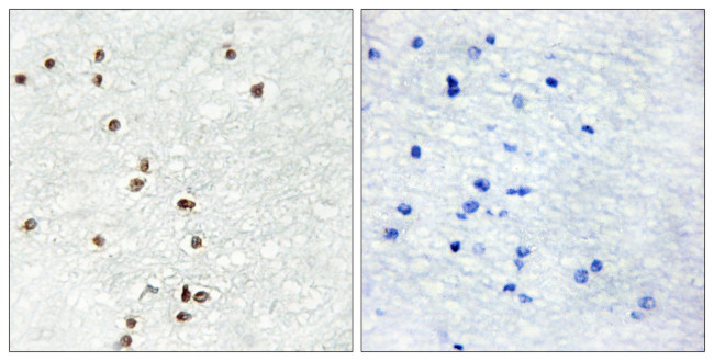 ZIC1/ZIC2/ZIC3 Antibody in Immunohistochemistry (Paraffin) (IHC (P))