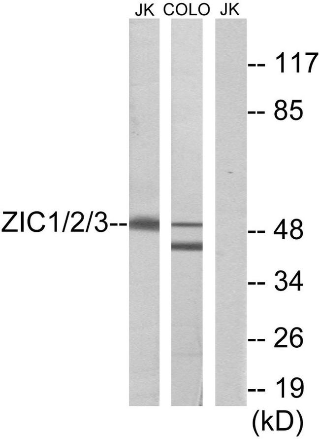 ZIC1/ZIC2/ZIC3 Antibody in Western Blot (WB)