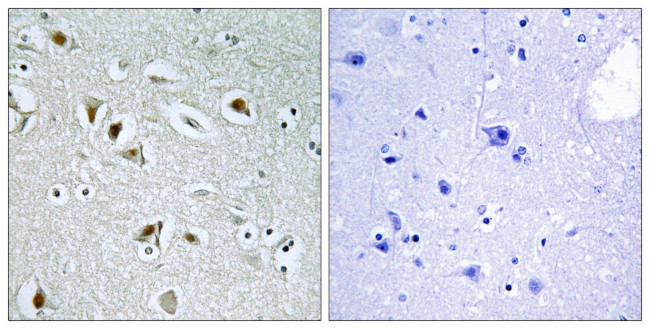 CDK2AP2 Antibody in Immunohistochemistry (Paraffin) (IHC (P))