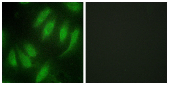 HEXIM1 Antibody in Immunocytochemistry (ICC/IF)