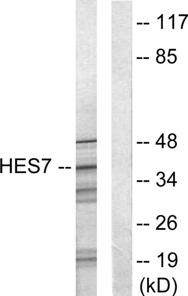 HEXIM1 Antibody in Western Blot (WB)