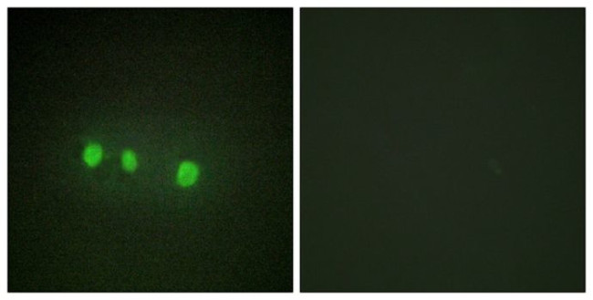 ZIC Pan Antibody in Immunocytochemistry (ICC/IF)