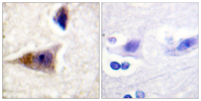 Phospho-Caspase 1 (Ser376) Antibody in Immunohistochemistry (Paraffin) (IHC (P))