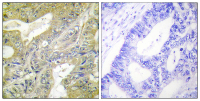 HEXB Antibody in Immunohistochemistry (Paraffin) (IHC (P))