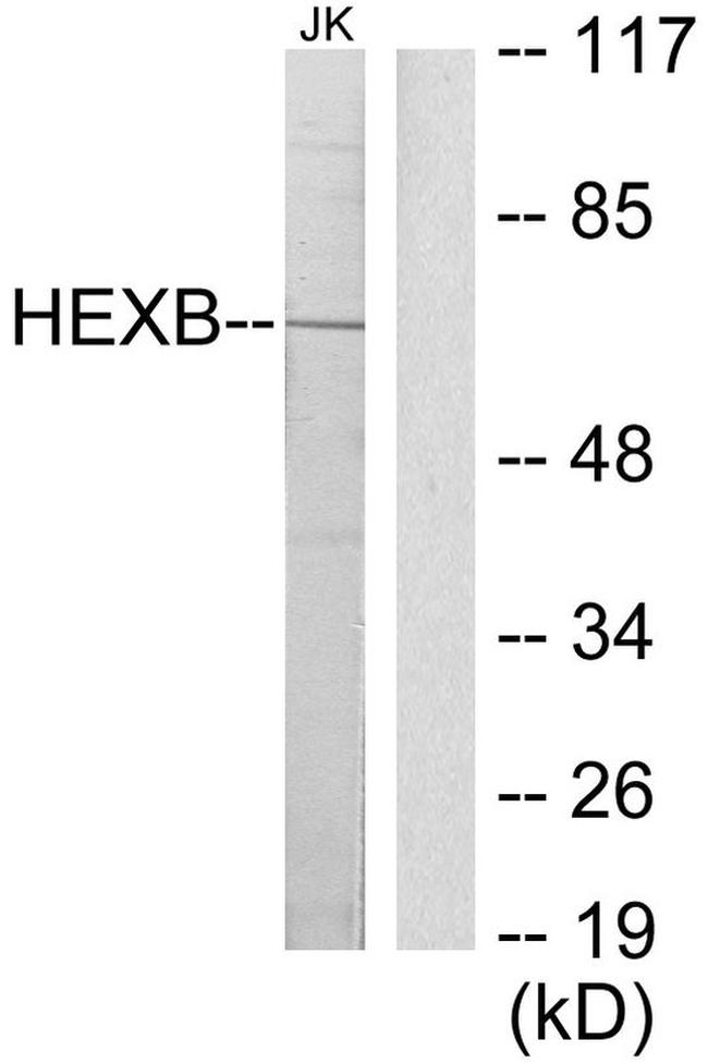 HEXB Antibody in Western Blot (WB)