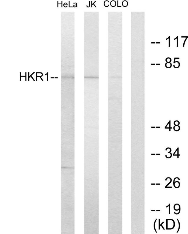 HKR1 Antibody in Western Blot (WB)