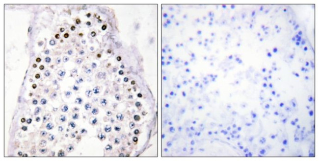 HOXA1/HOXB1/HOXD1 Antibody in Immunohistochemistry (Paraffin) (IHC (P))