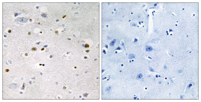 ZNF7 Antibody in Immunohistochemistry (Paraffin) (IHC (P))