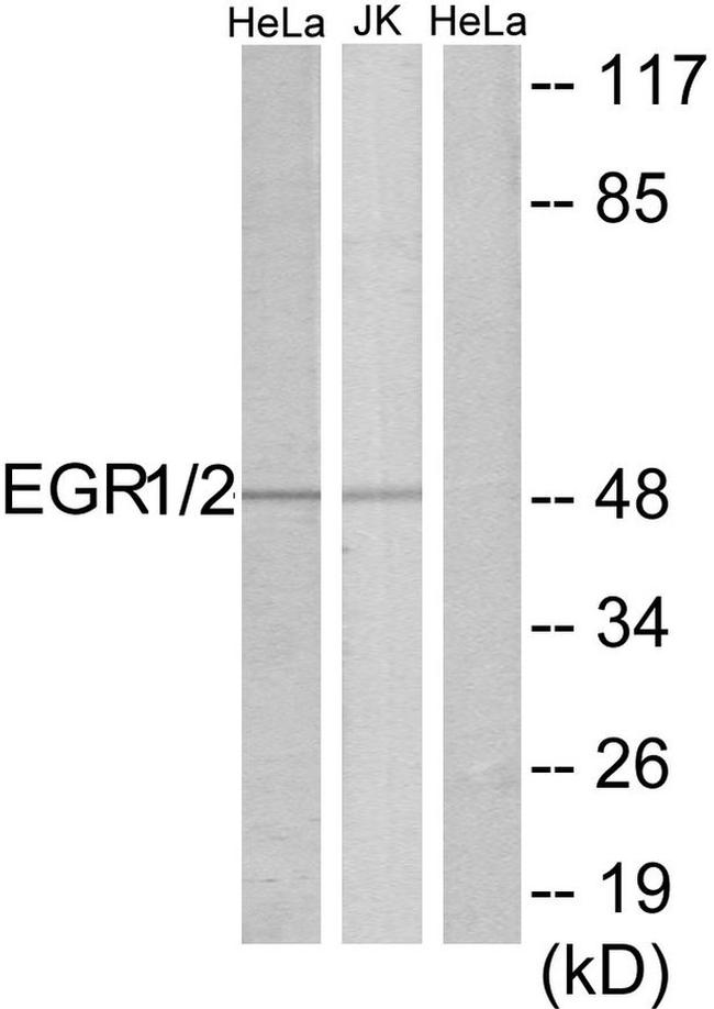 EGR1/EGR2 Antibody in Western Blot (WB)