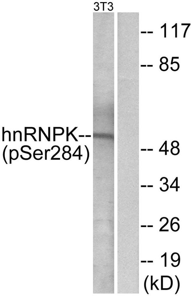 Phospho-hnRNP K (Ser284) Antibody in Western Blot (WB)