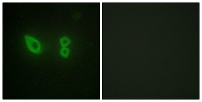 alpha Actinin 2/3 Antibody in Immunocytochemistry (ICC/IF)