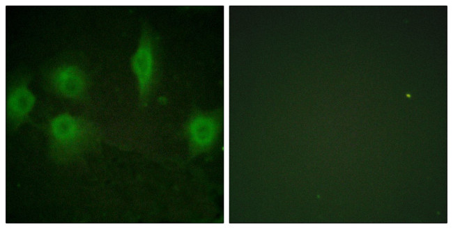 Phospho-IL9R (Ser519) Antibody in Immunocytochemistry (ICC/IF)