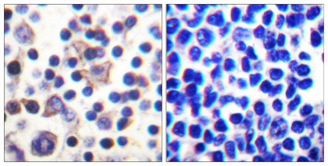 Phospho-IL9R (Ser519) Antibody in Immunohistochemistry (Paraffin) (IHC (P))