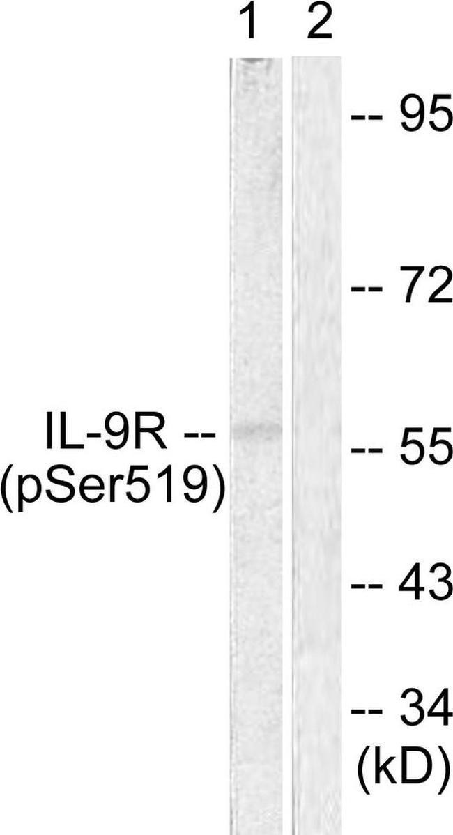 Phospho-IL9R (Ser519) Antibody in Western Blot (WB)