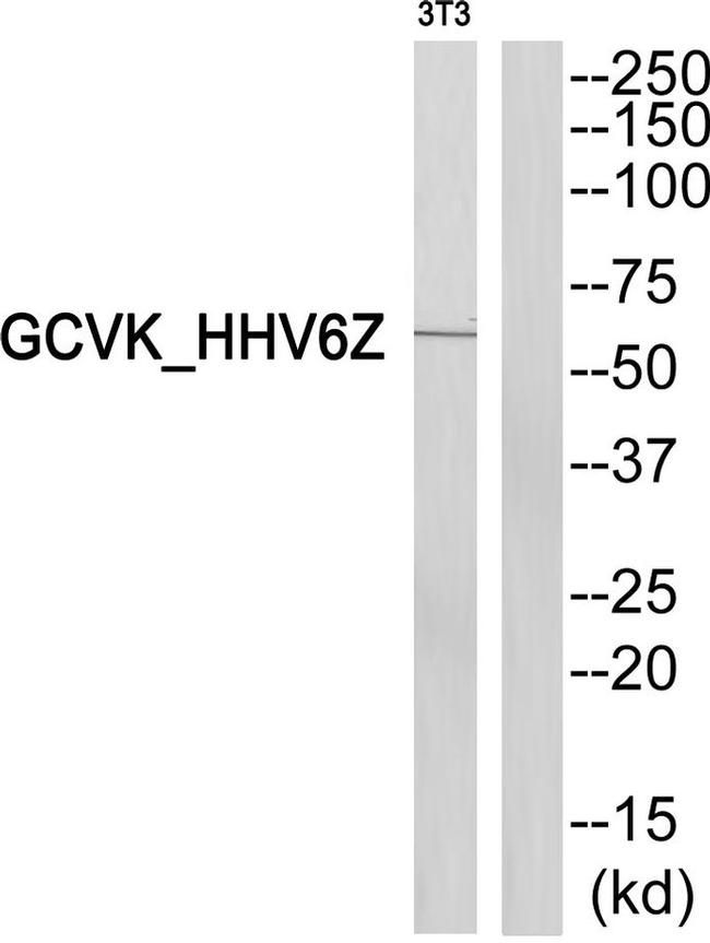 HHV-6 U69 Antibody in Western Blot (WB)