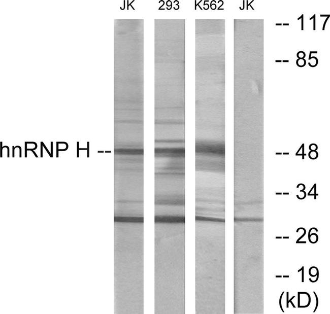 hnRNP H2 Antibody in Western Blot (WB)