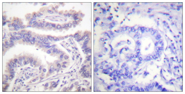 Phospho-KIF11 (Thr926) Antibody in Immunohistochemistry (Paraffin) (IHC (P))