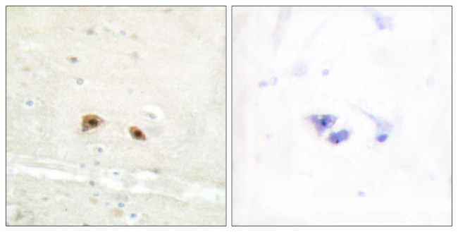 EGR3 Antibody in Immunohistochemistry (Paraffin) (IHC (P))