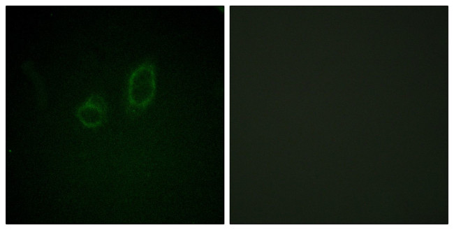 Phospho-Ezrin/Radixin/Moesin (Thr558) Antibody in Immunocytochemistry (ICC/IF)