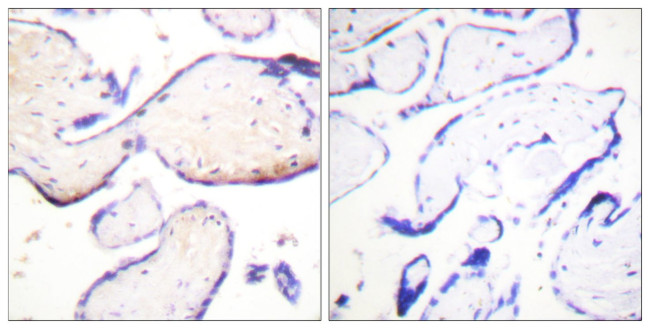 Phospho-Ezrin/Radixin/Moesin (Thr558) Antibody in Immunohistochemistry (Paraffin) (IHC (P))