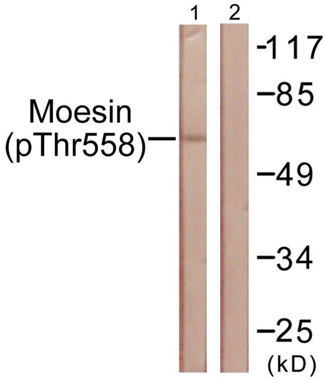 Phospho-Ezrin/Radixin/Moesin (Thr558) Antibody in Western Blot (WB)