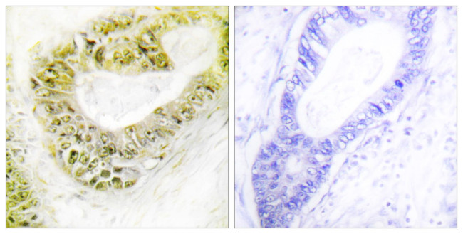 ZNF638 Antibody in Immunohistochemistry (Paraffin) (IHC (P))