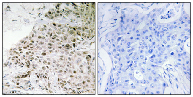 TAF13 Antibody in Immunohistochemistry (Paraffin) (IHC (P))