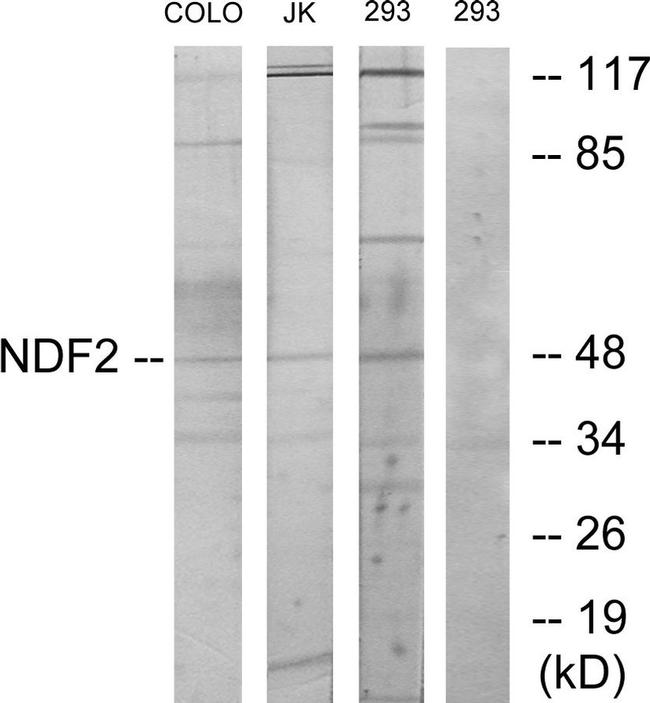 NeuroD2 Antibody in Western Blot (WB)