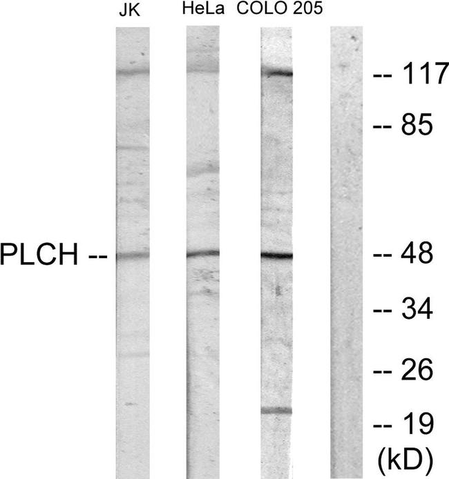 AGPAT9 Antibody in Western Blot (WB)