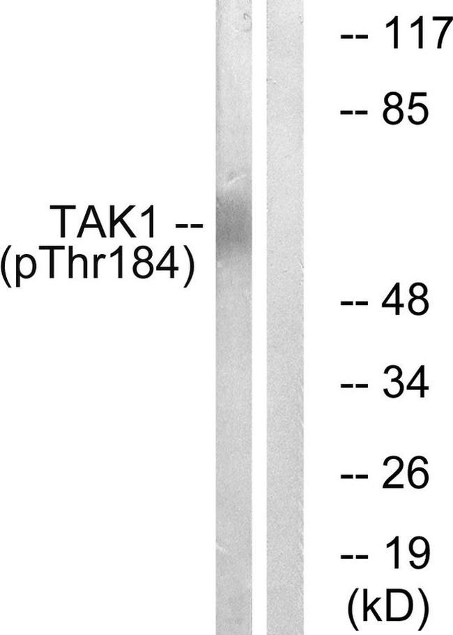 Phospho-TAK1 (Thr184) Antibody in Western Blot (WB)