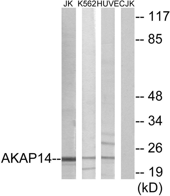 AKAP14 Antibody in Western Blot (WB)