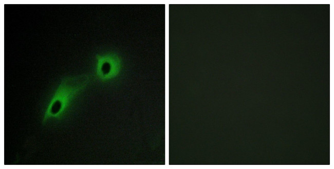 CaMKV Antibody in Immunocytochemistry (ICC/IF)