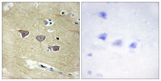 CaMKV Antibody in Immunohistochemistry (Paraffin) (IHC (P))