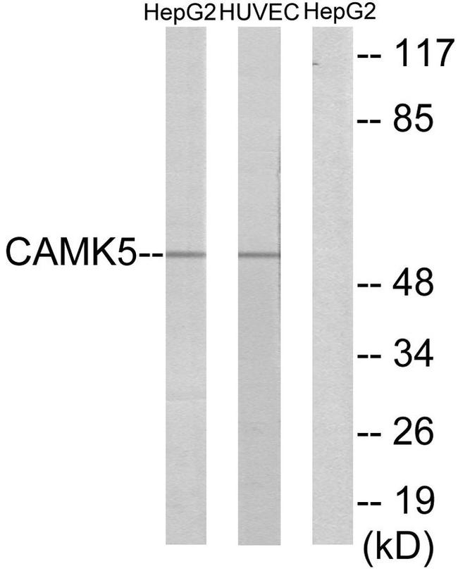 CaMKV Antibody in Western Blot (WB)