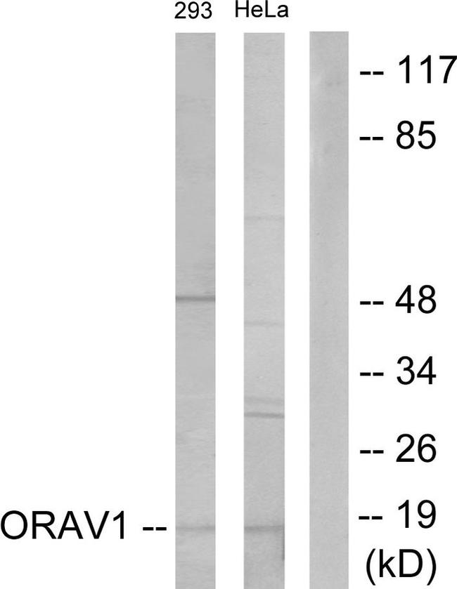 ORAOV1 Antibody in Western Blot (WB)