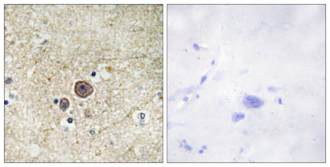 Phospho-alpha Catenin (Ser641) Antibody in Immunohistochemistry (Paraffin) (IHC (P))