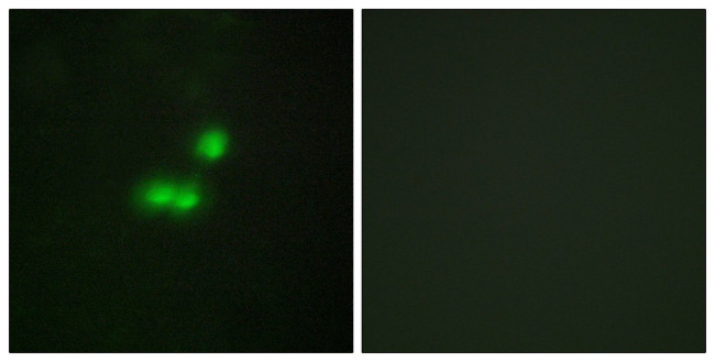 BRF1 Antibody in Immunocytochemistry (ICC/IF)