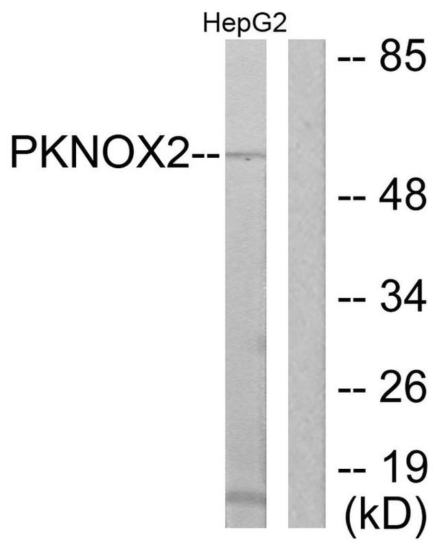 PKNOX2 Antibody in Western Blot (WB)